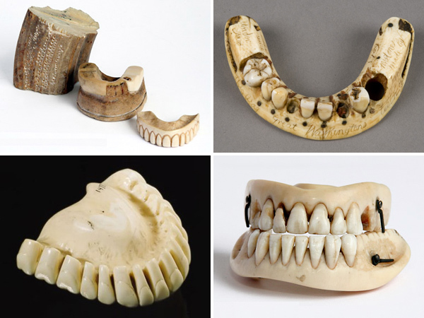 washingtons-teeth