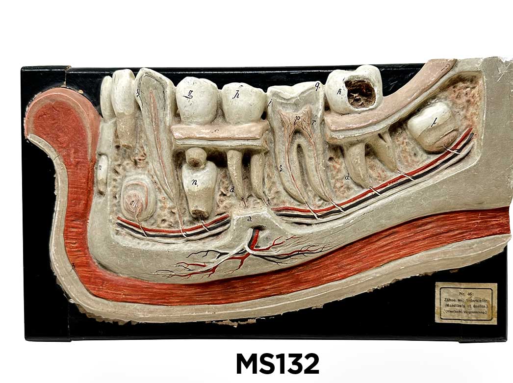 ms132