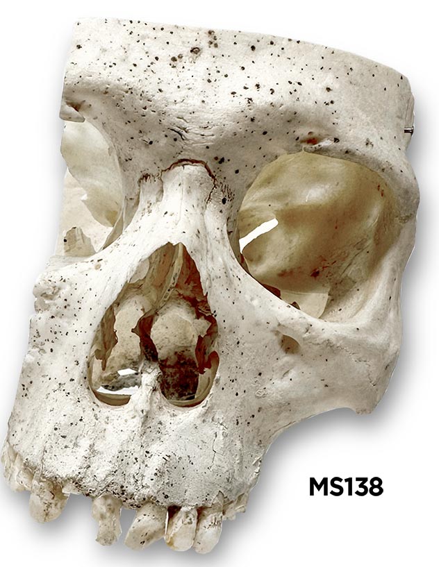 skull