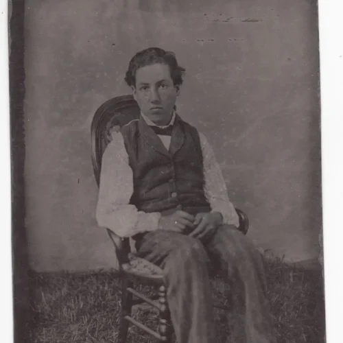 Tintype Medical Condition