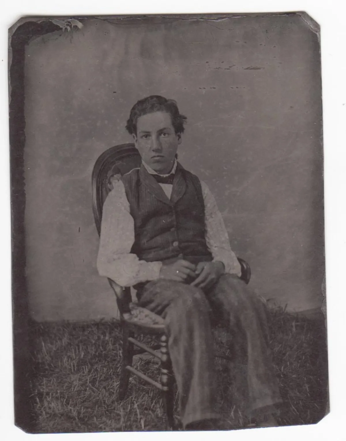 Tintype Medical Condition