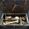 Victorian Partial Skeleton in Handcrafted Strongbox