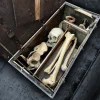 Victorian Partial Skeleton in Handcrafted Strongbox