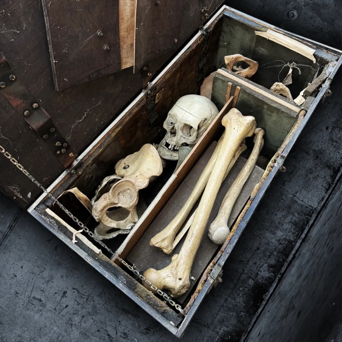 Victorian Partial Skeleton in Handcrafted Strongbox
