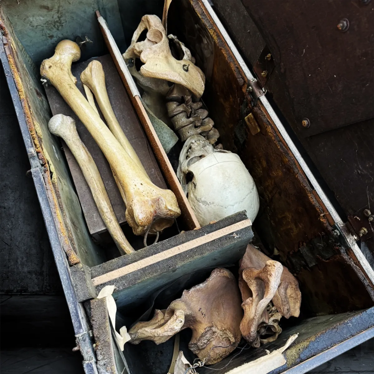Victorian Partial Skeleton in Handcrafted Strongbox