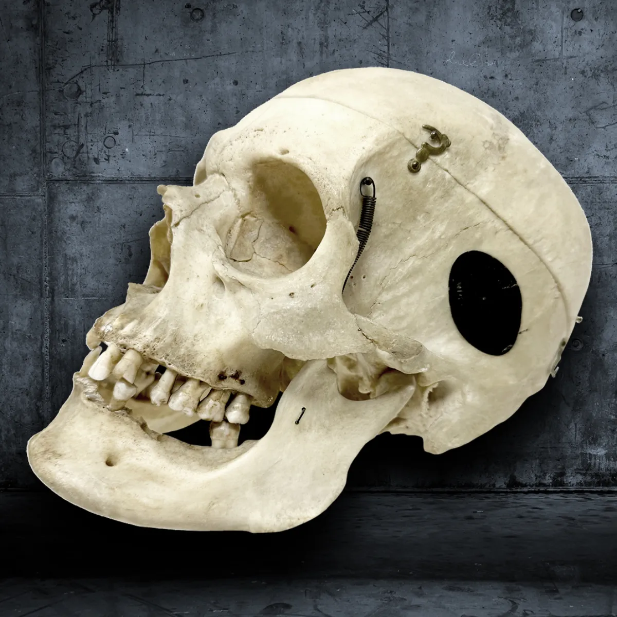 Victorian Partial Skeleton in Handcrafted Strongbox