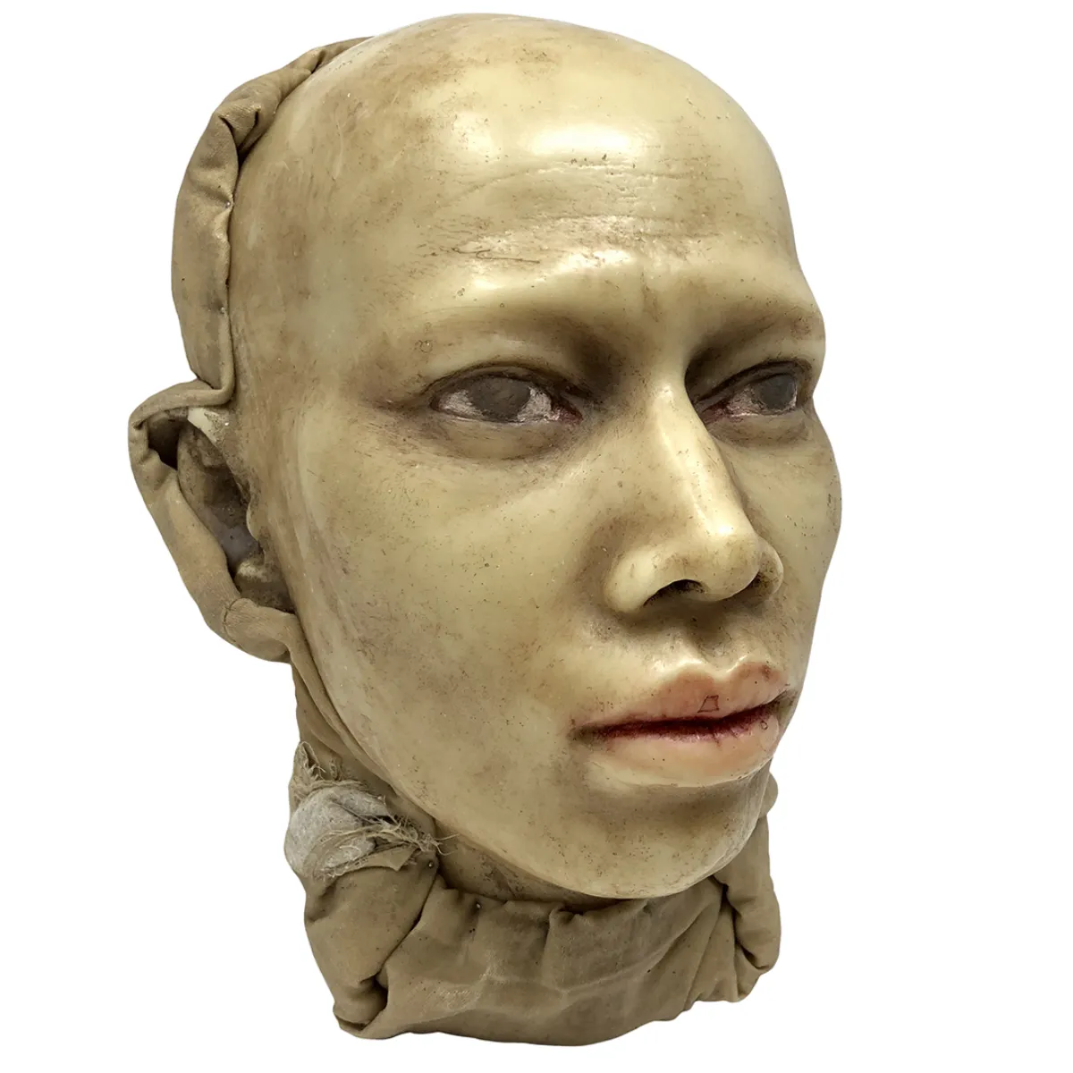 MS1273 19th Century Wax Head Medical Study