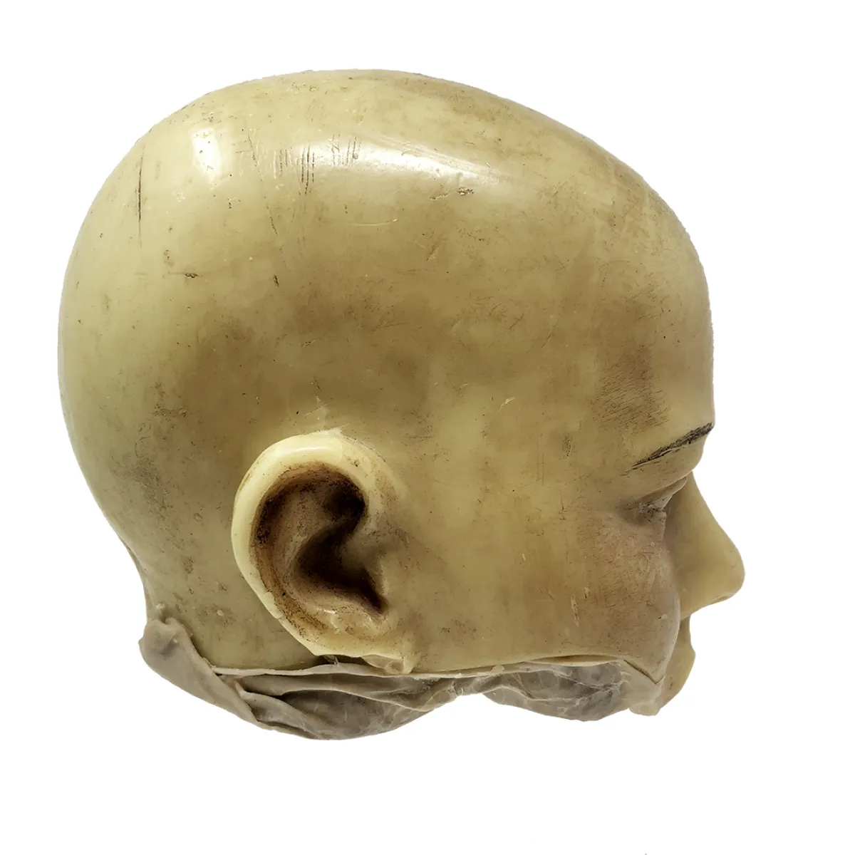 MS1283 Stunningly Macabre 19th Century Wax Half Head Medical Study