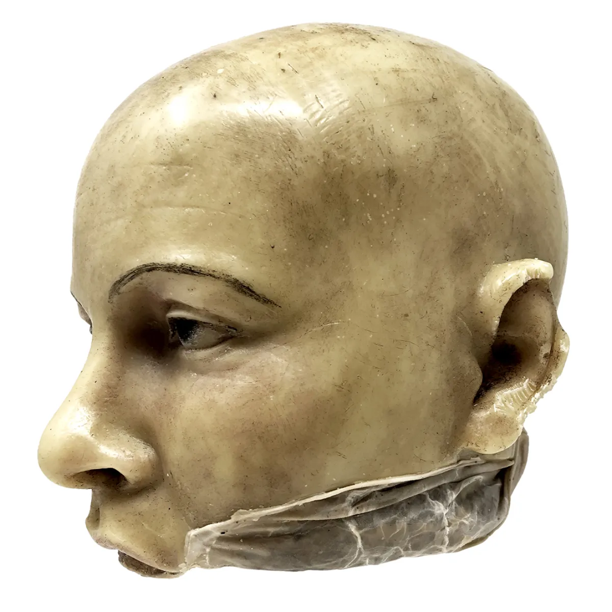 MS1284 Stunningly Macabre 19th Century Wax Half Head Medical Study