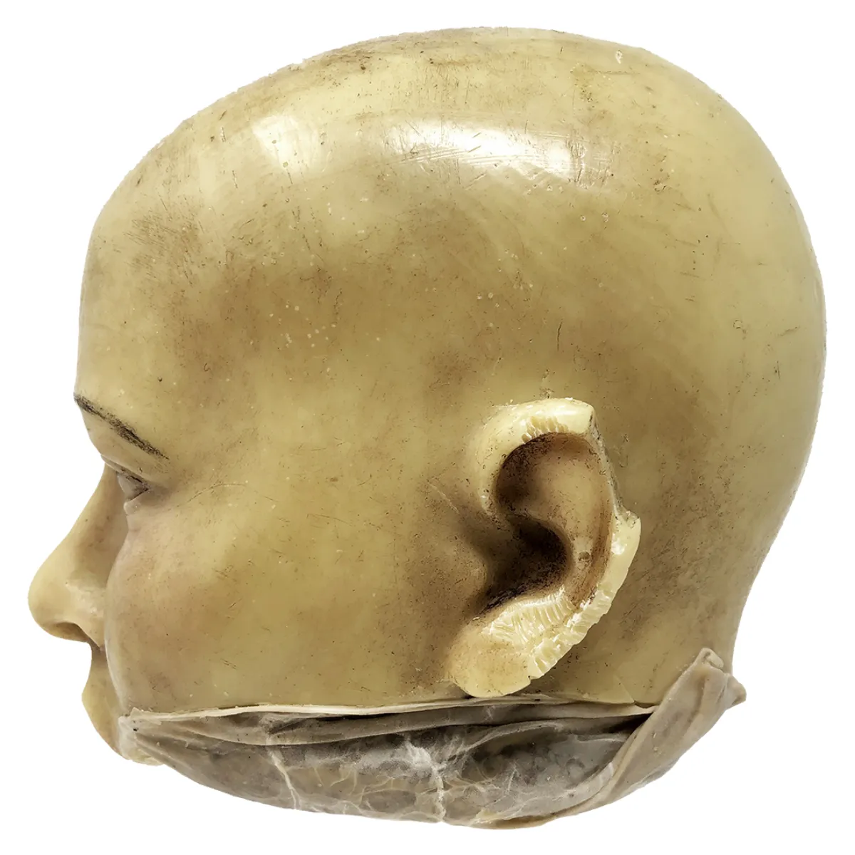 MS1285 Stunningly Macabre 19th Century Wax Half Head Medical Study