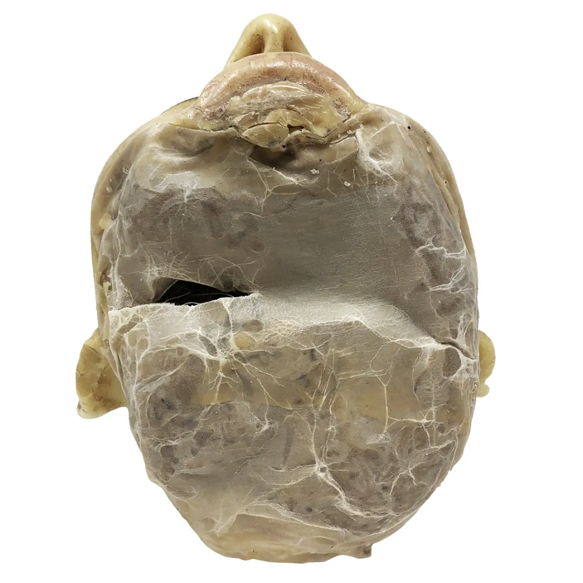 MS1287 Stunningly Macabre 19th Century Wax Half Head Medical Study