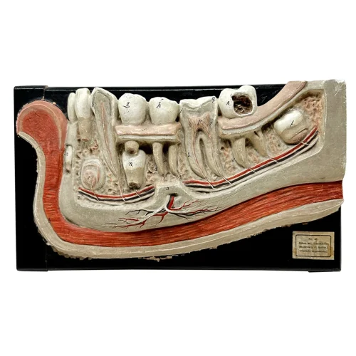 Anatomical Bock-Steger Jaw Model