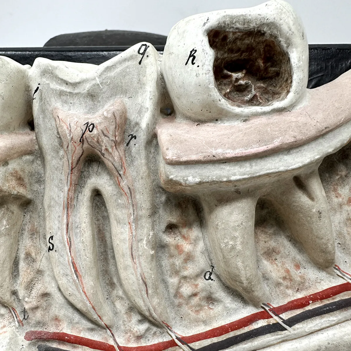 MS1323 Anatomical Bock-Steger Jaw Model