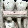 MS1324 Anatomical Bock-Steger Jaw Model
