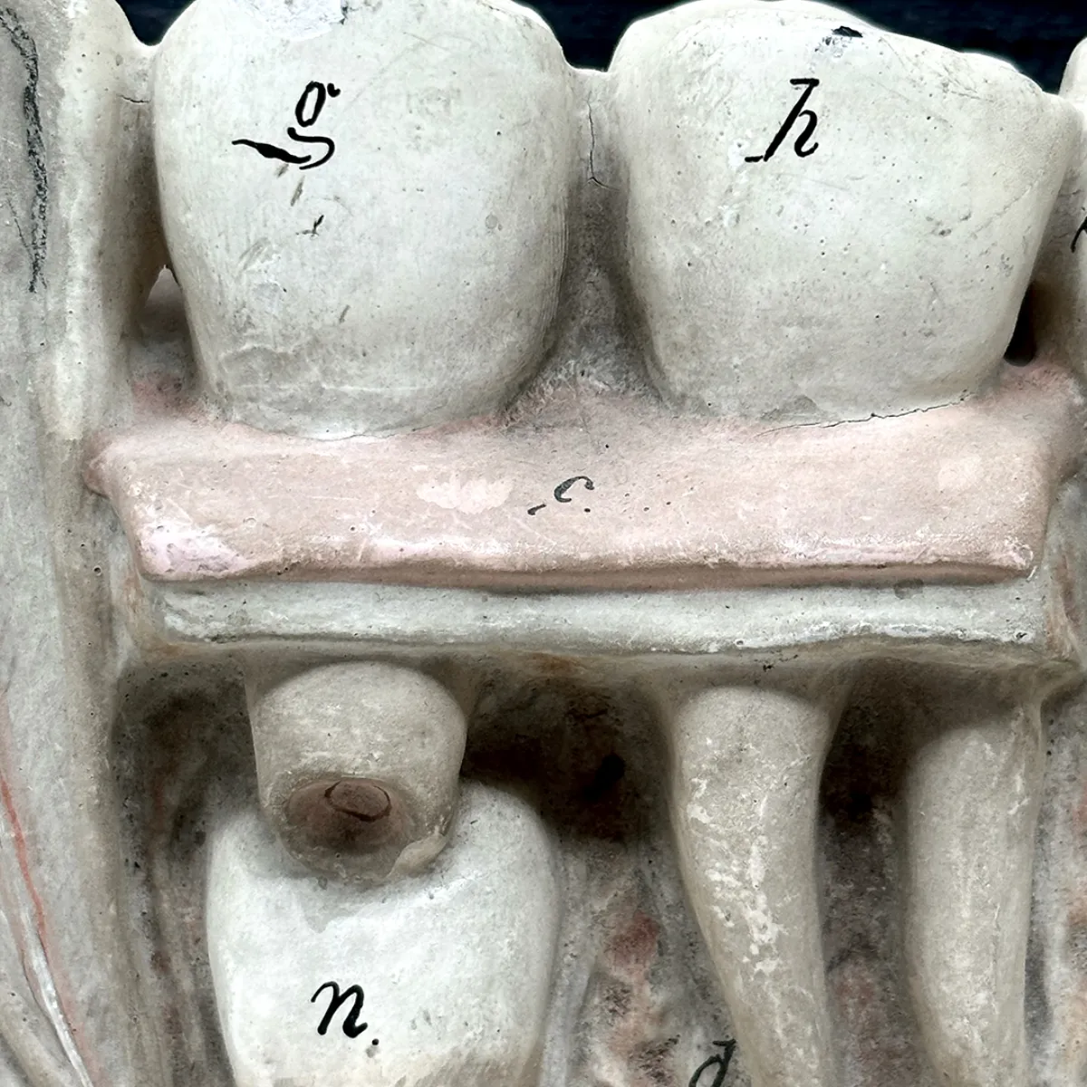 MS1324 Anatomical Bock-Steger Jaw Model
