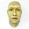 MS1841 Haunting and Macabre 19th Century Wax Head Medical Study
