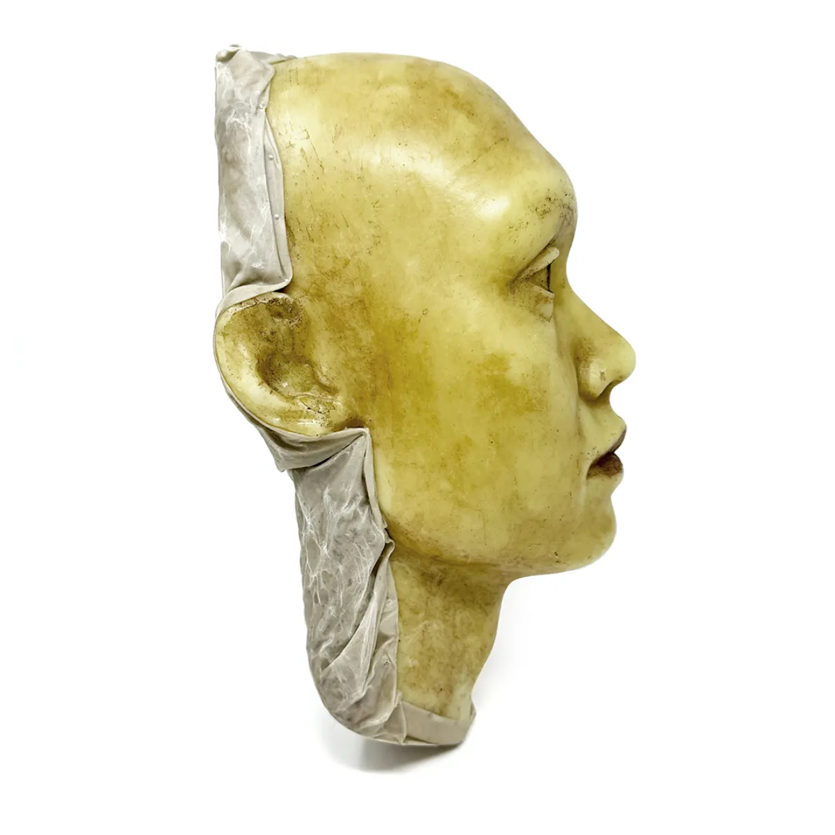 MS1842 Haunting and Macabre 19th Century Wax Head Medical Study
