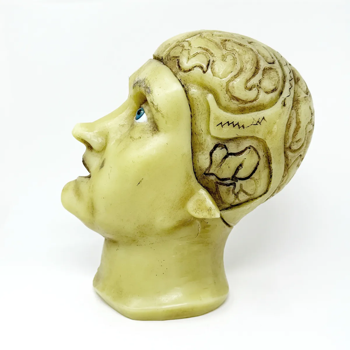 MS1851 Stunningly Macabre 19th Century Wax Half Head Medical Study