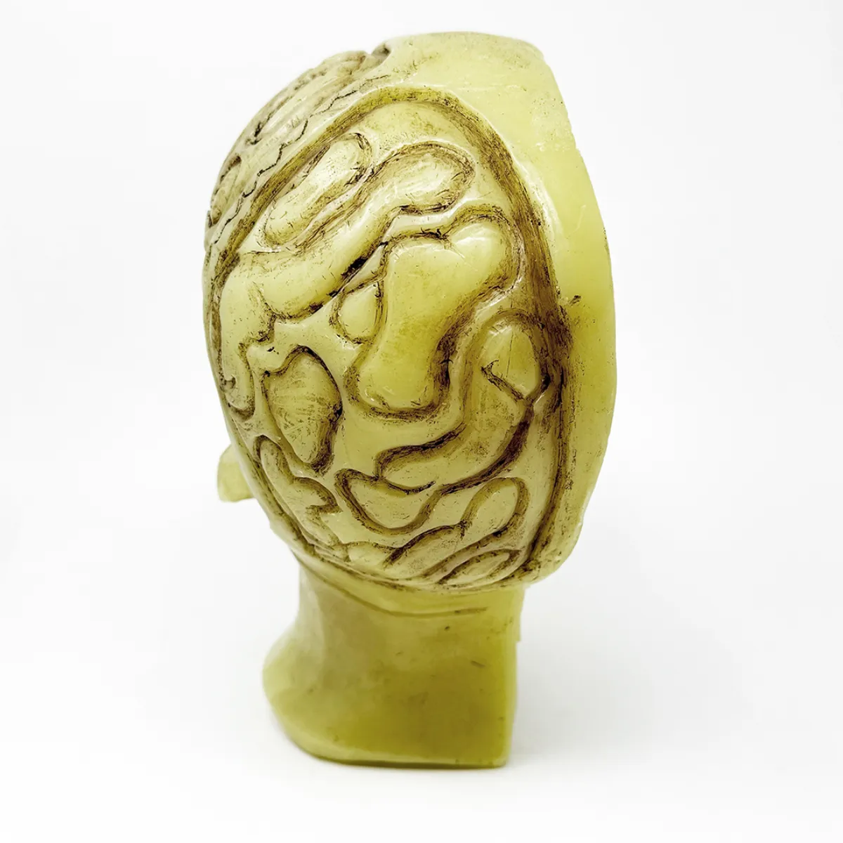 MS1853 Stunningly Macabre 19th Century Wax Half Head Medical Study