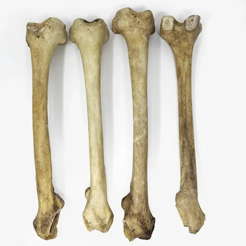 Real Human Femur Bone