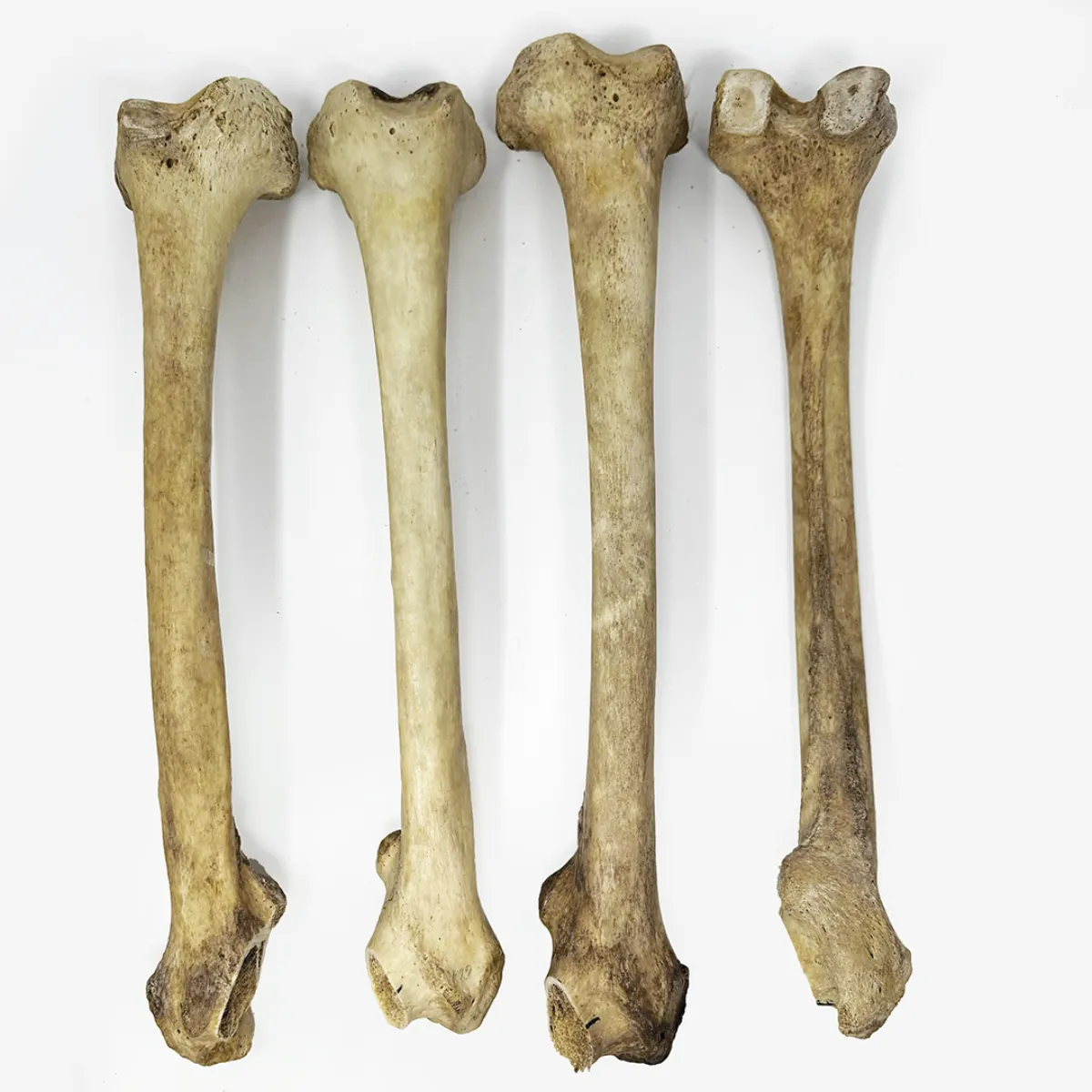 MS1871 Real Human Femur Bone