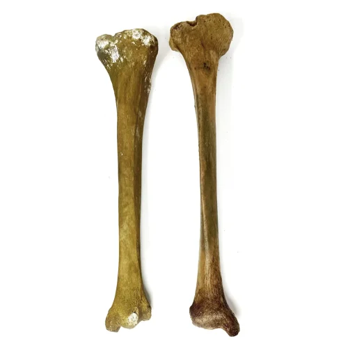 Real Human Tibia Bone