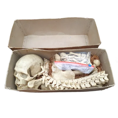 Rare Early 20th Century Medical Study Half Human Skeleton