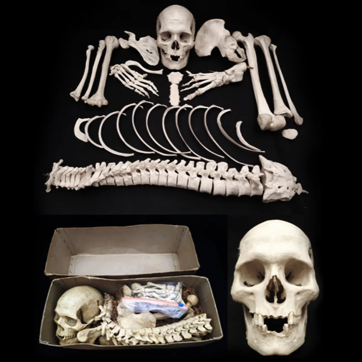 Rare Early 20th Century Medical Study Half Human Skeleton