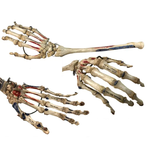 Victorian Medical Teaching Aid Articulated Human Skeletal Arm