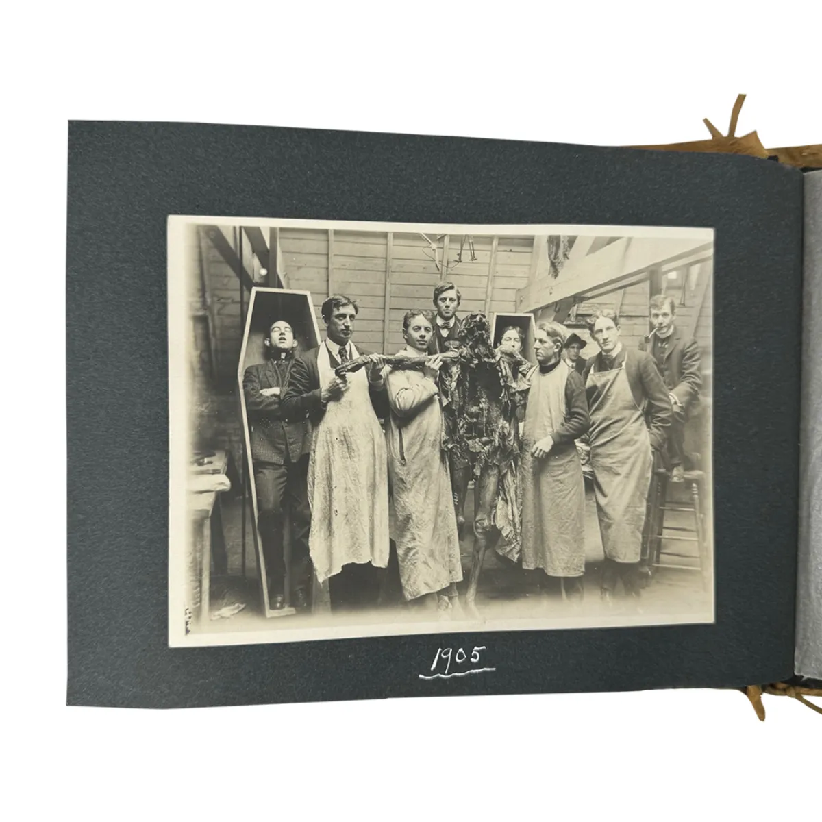 MS2315 1905 Grisly Medical School Autopsy Cadaver Photo Album