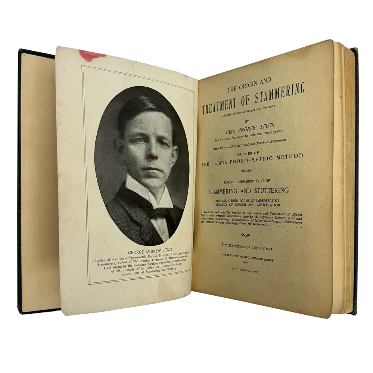1907 The Origin and Treatment of Stammering