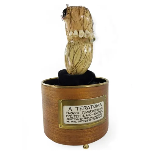 Original Sculpture Titled Teratoma – Created Specifically for Billy Jamieson