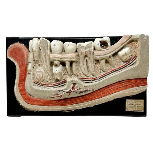 MS003 — 19th Century Anatomical Bock-Steger Jaw Model 19th century plaster Bock-Steger anatomical underjaw model, cross section revealing nerves and tooth roots