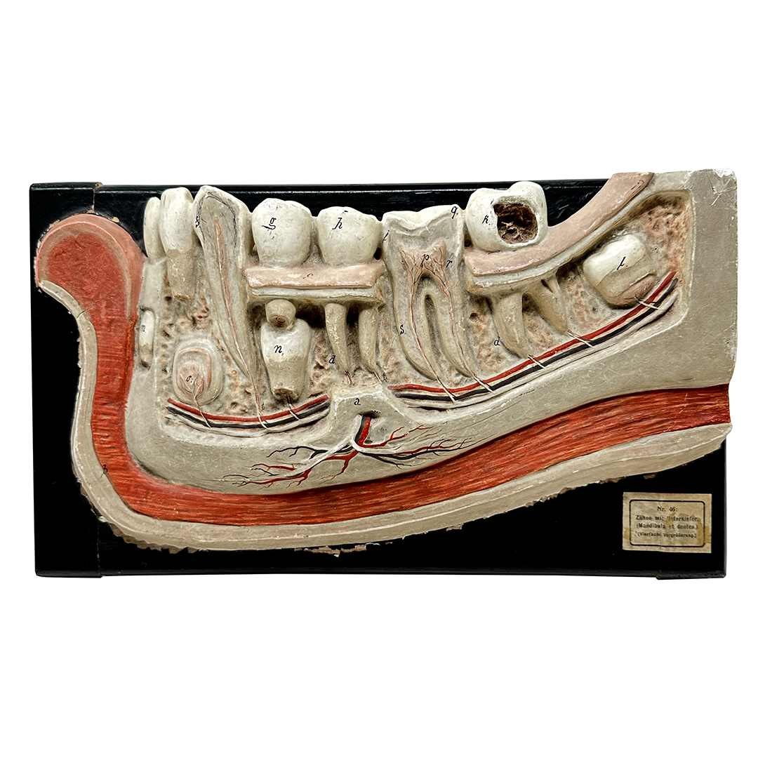 MS003 — 19th Century Anatomical Bock-Steger Jaw Model 19th century plaster Bock-Steger anatomical underjaw model, cross section revealing nerves and tooth roots