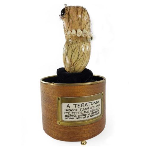 MS015 — Original Sculpture 'Teratoma', Created for Billy Jamieson Artist-signed music box sculpture of a teratoma by John Nakamura, 1999, made for collector Billy Jamieson
